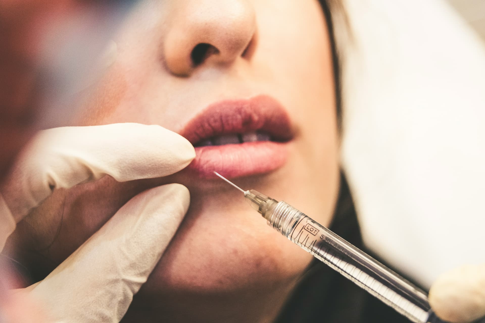 مقایسه لیزر و IPL
